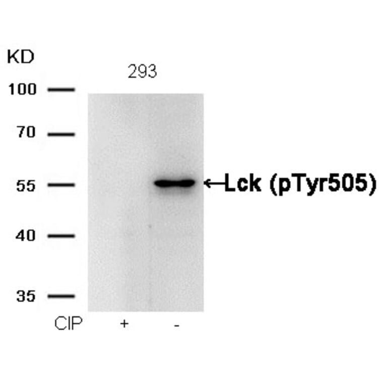 Western blot - Lck (phospho-Tyr505) Antibody from Signalway Antibody (11537) - Antibodies.com