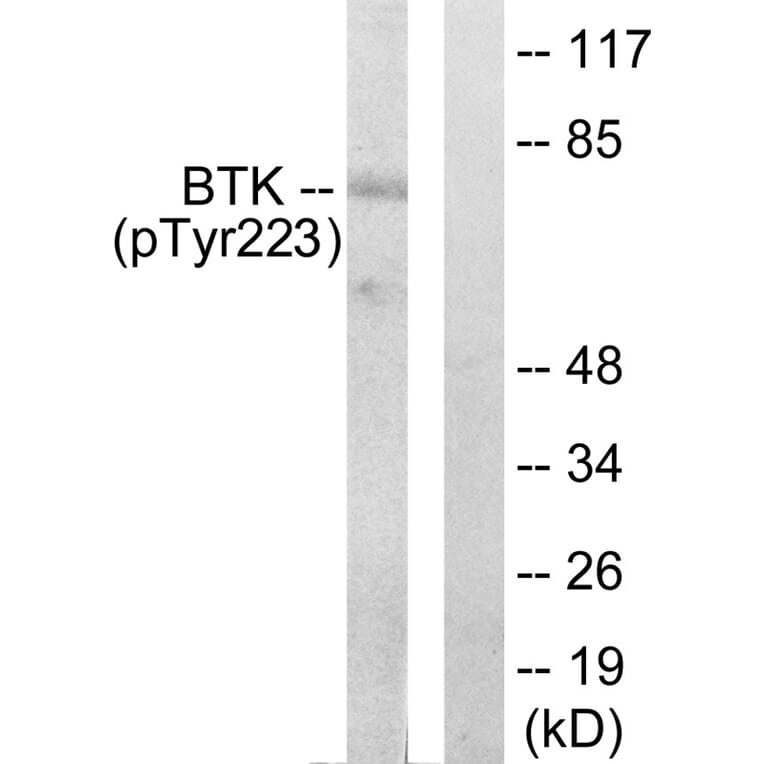 Western blot - BTK (Phospho-Tyr223) Antibody from Signalway Antibody (11647) - Antibodies.com