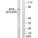 Western blot - BTK (Phospho-Tyr223) Antibody from Signalway Antibody (11647) - Antibodies.com