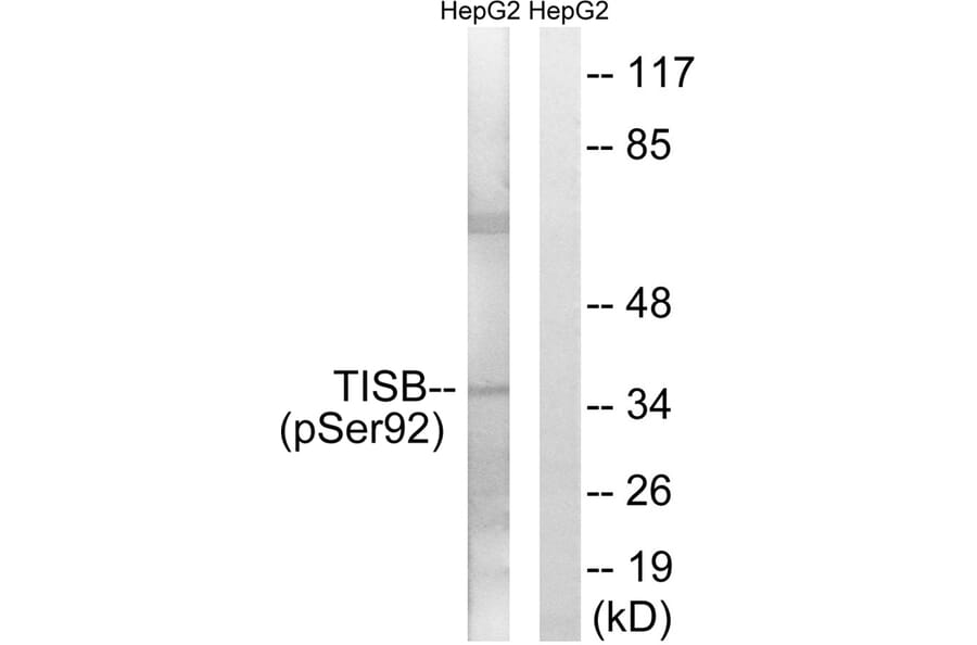 Western blot - TISB (Phospho-Ser92) Antibody from Signalway Antibody (11705) - Antibodies.com