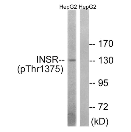 Western blot - IR (Phospho-Thr1375) Antibody from Signalway Antibody (11734) - Antibodies.com