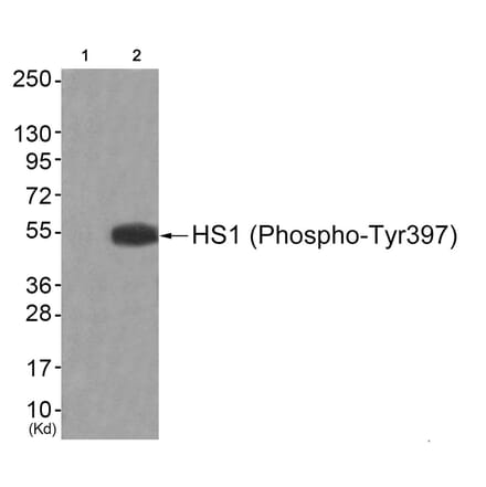 Western blot - HS1 (Phospho-Tyr397) Antibody from Signalway Antibody (11817) - Antibodies.com