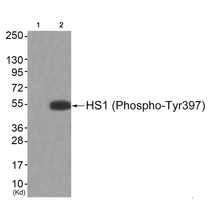 Western blot - HS1 (Phospho-Tyr397) Antibody from Signalway Antibody (11817) - Antibodies.com