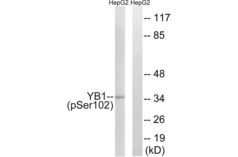 Western blot - YB1 (Phospho-Ser102) Antibody from Signalway Antibody (11819) - Antibodies.com