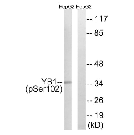 Western blot - YB1 (Phospho-Ser102) Antibody from Signalway Antibody (11819) - Antibodies.com
