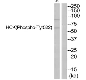 Western blot - HCK (Phospho-Tyr522) Antibody from Signalway Antibody (11822) - Antibodies.com