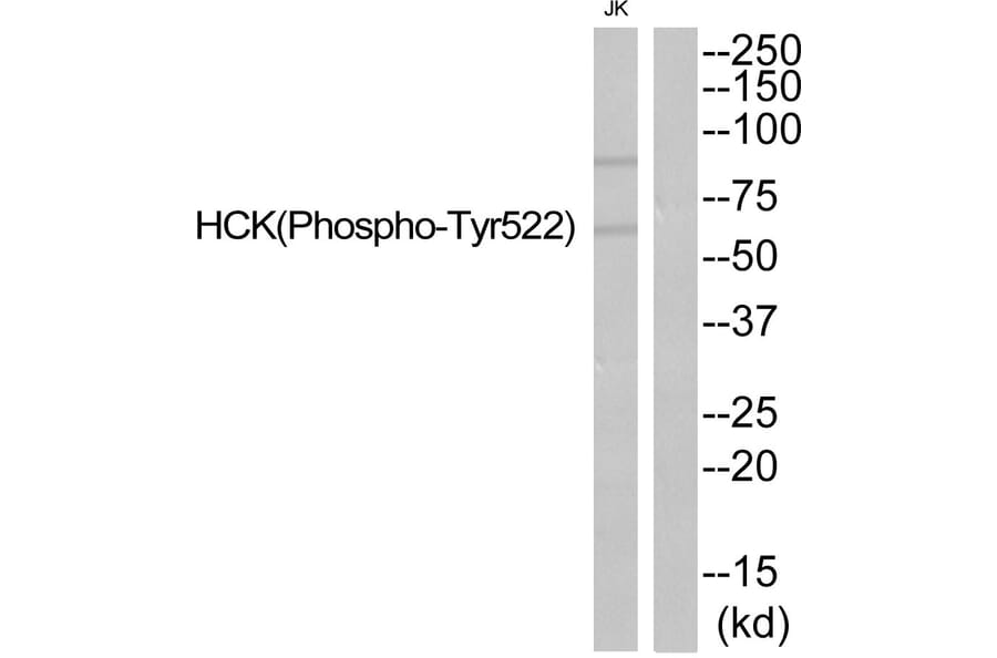 Western blot - HCK (Phospho-Tyr522) Antibody from Signalway Antibody (11822) - Antibodies.com