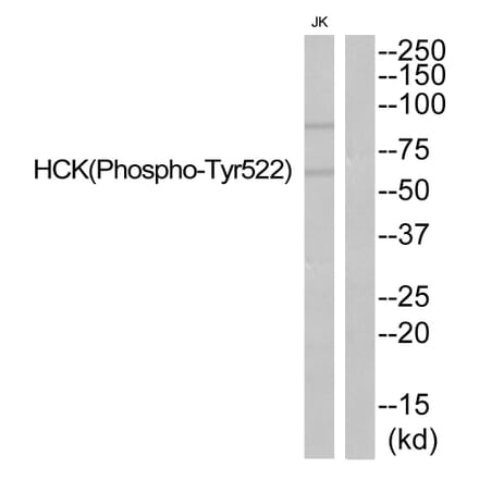 Western blot - HCK (Phospho-Tyr522) Antibody from Signalway Antibody (11822) - Antibodies.com