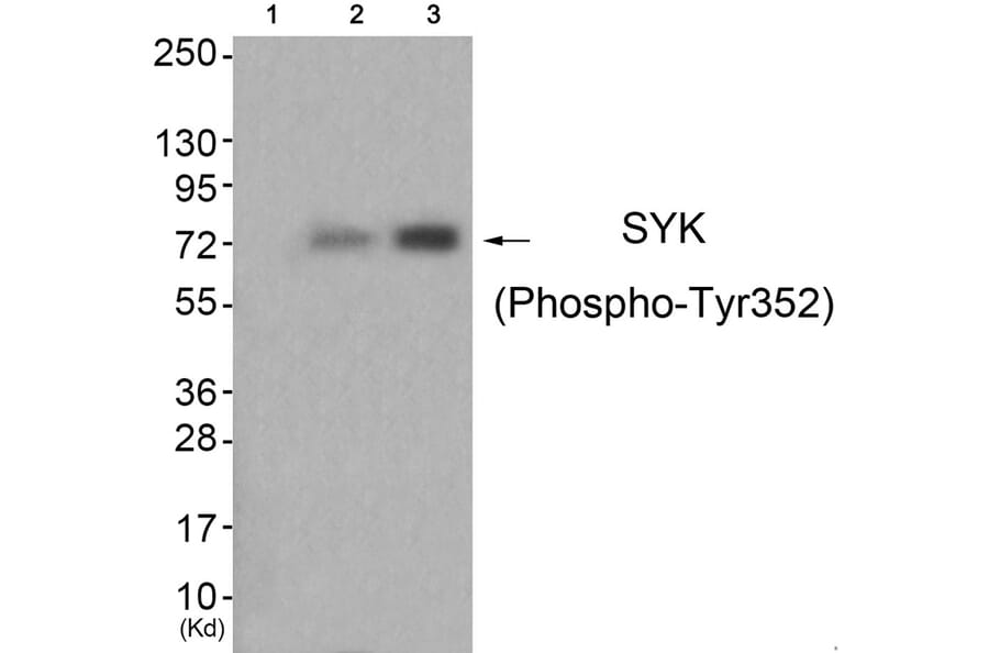 Western blot - SYK (Phospho-Tyr352) Antibody from Signalway Antibody (11827) - Antibodies.com