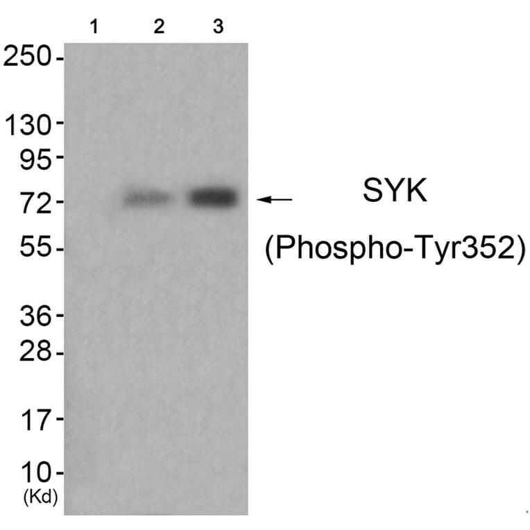 Western blot - SYK (Phospho-Tyr352) Antibody from Signalway Antibody (11827) - Antibodies.com