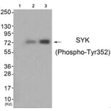 Western blot - SYK (Phospho-Tyr352) Antibody from Signalway Antibody (11827) - Antibodies.com