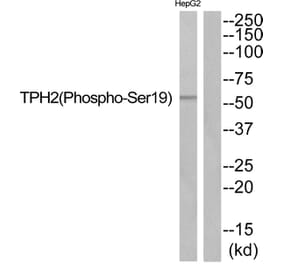 Western blot - TPH2 (Phospho-Ser19) Antibody from Signalway Antibody (11828) - Antibodies.com