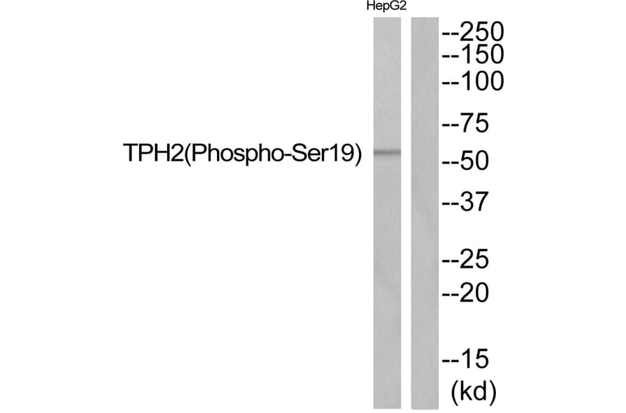 Western blot - TPH2 (Phospho-Ser19) Antibody from Signalway Antibody (11828) - Antibodies.com