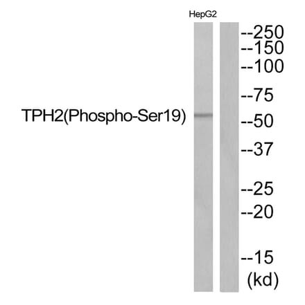 Western blot - TPH2 (Phospho-Ser19) Antibody from Signalway Antibody (11828) - Antibodies.com