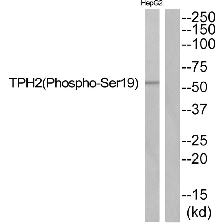 Western blot - TPH2 (Phospho-Ser19) Antibody from Signalway Antibody (11828) - Antibodies.com