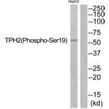 Western blot - TPH2 (Phospho-Ser19) Antibody from Signalway Antibody (11828) - Antibodies.com