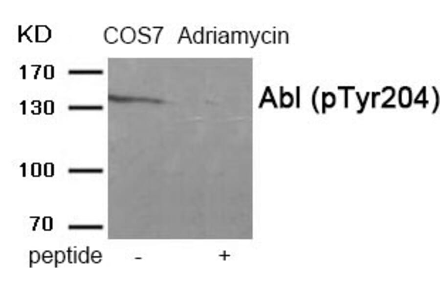 Western blot - Abl (Phospho-Tyr204) Antibody from Signalway Antibody (11901) - Antibodies.com