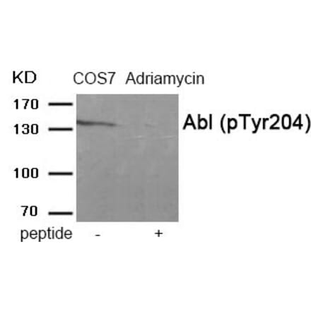 Western blot - Abl (Phospho-Tyr204) Antibody from Signalway Antibody (11901) - Antibodies.com