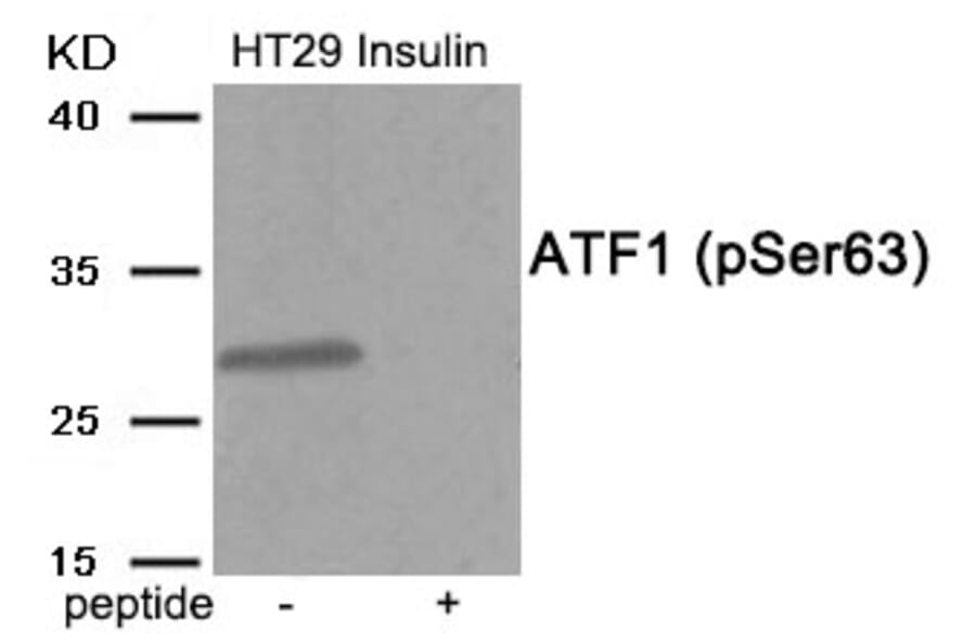 Western blot - ATF1 (Phospho-Ser63) Antibody from Signalway Antibody (11913) - Antibodies.com