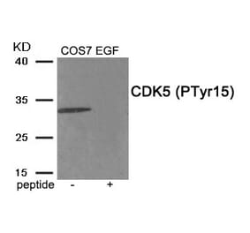 Western blot - CDK5 (Phospho-Tyr15) Antibody from Signalway Antibody (11918) - Antibodies.com