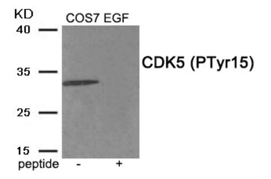 Western blot - CDK5 (Phospho-Tyr15) Antibody from Signalway Antibody (11918) - Antibodies.com