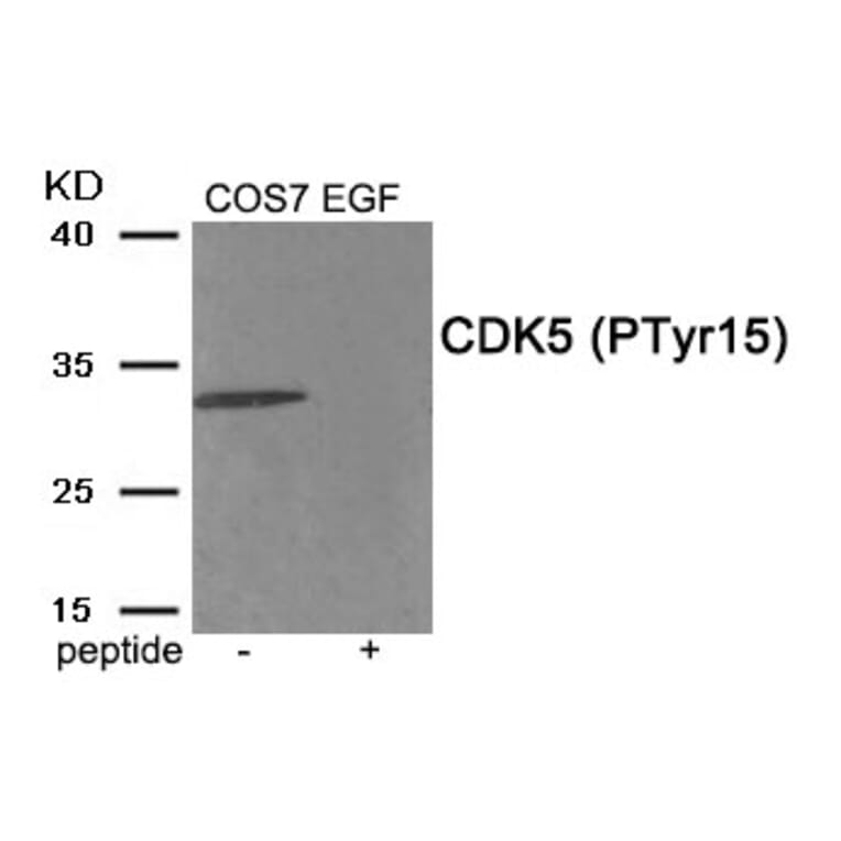 Western blot - CDK5 (Phospho-Tyr15) Antibody from Signalway Antibody (11918) - Antibodies.com