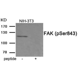 Western blot - FAK (Phospho-Ser843) Antibody from Signalway Antibody (11920) - Antibodies.com