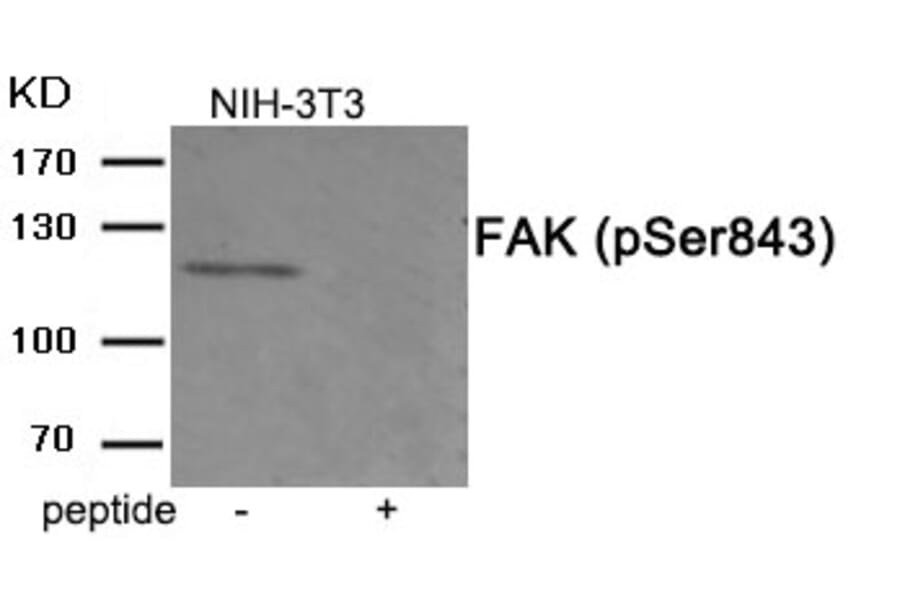 Western blot - FAK (Phospho-Ser843) Antibody from Signalway Antibody (11920) - Antibodies.com