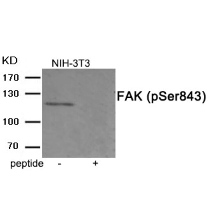 Western blot - FAK (Phospho-Ser843) Antibody from Signalway Antibody (11920) - Antibodies.com