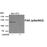 Western blot - FAK (Phospho-Ser843) Antibody from Signalway Antibody (11920) - Antibodies.com