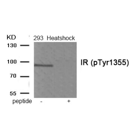 Western blot - IR (Phospho-Tyr1355) Antibody from Signalway Antibody (11939) - Antibodies.com