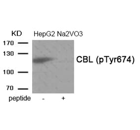 Western blot - CBL (Phospho-Tyr674) Antibody from Signalway Antibody (11946) - Antibodies.com