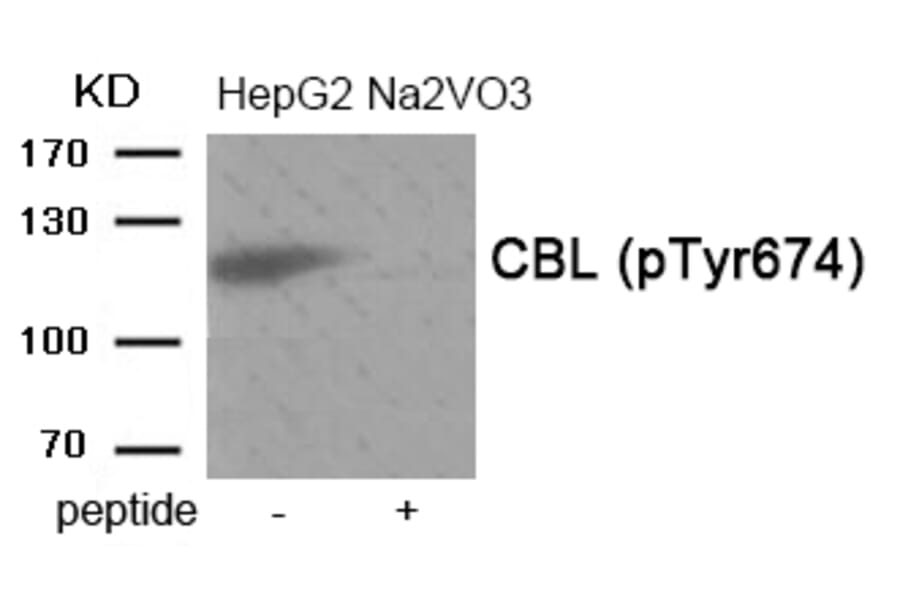 Western blot - CBL (Phospho-Tyr674) Antibody from Signalway Antibody (11946) - Antibodies.com