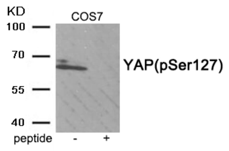 Western blot - YAP (Phospho-Ser127) Antibody from Signalway Antibody (11952) - Antibodies.com