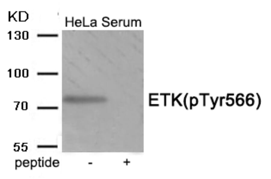 Western blot - ETK (Phospho-Tyr566) Antibody from Signalway Antibody (11953) - Antibodies.com