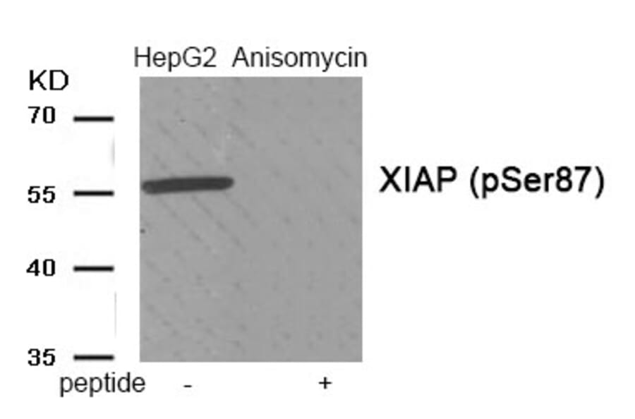 Western blot - XIAP (Phospho-Ser87) Antibody from Signalway Antibody (11956) - Antibodies.com