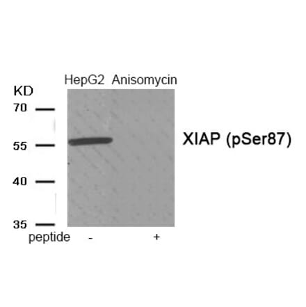 Western blot - XIAP (Phospho-Ser87) Antibody from Signalway Antibody (11956) - Antibodies.com
