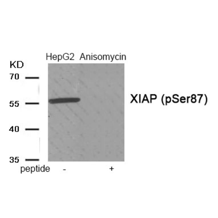 Western blot - XIAP (Phospho-Ser87) Antibody from Signalway Antibody (11956) - Antibodies.com