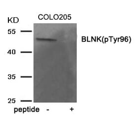 Western blot - BLNK (Phospho-Tyr96) Antibody from Signalway Antibody (11964) - Antibodies.com