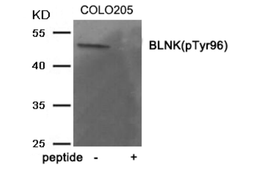 Western blot - BLNK (Phospho-Tyr96) Antibody from Signalway Antibody (11964) - Antibodies.com