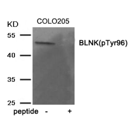 Western blot - BLNK (Phospho-Tyr96) Antibody from Signalway Antibody (11964) - Antibodies.com