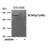 Western blot - BLNK (Phospho-Tyr96) Antibody from Signalway Antibody (11964) - Antibodies.com