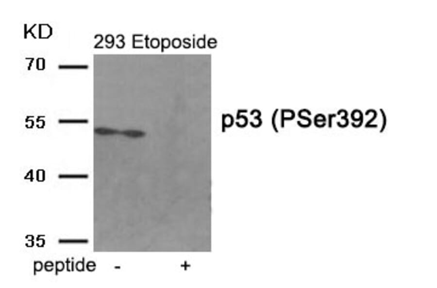 Western blot - p53 (Phospho-Ser392) Antibody from Signalway Antibody (11969) - Antibodies.com