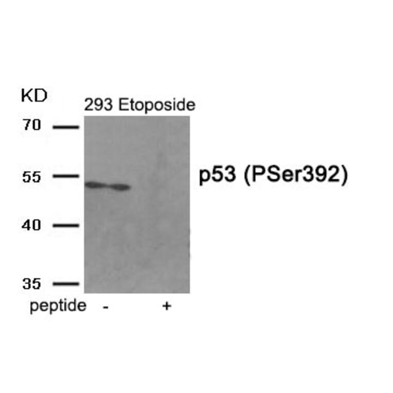 Western blot - p53 (Phospho-Ser392) Antibody from Signalway Antibody (11969) - Antibodies.com
