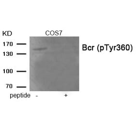 Western blot - Bcr (Phospho-Tyr360) Antibody from Signalway Antibody (11972) - Antibodies.com