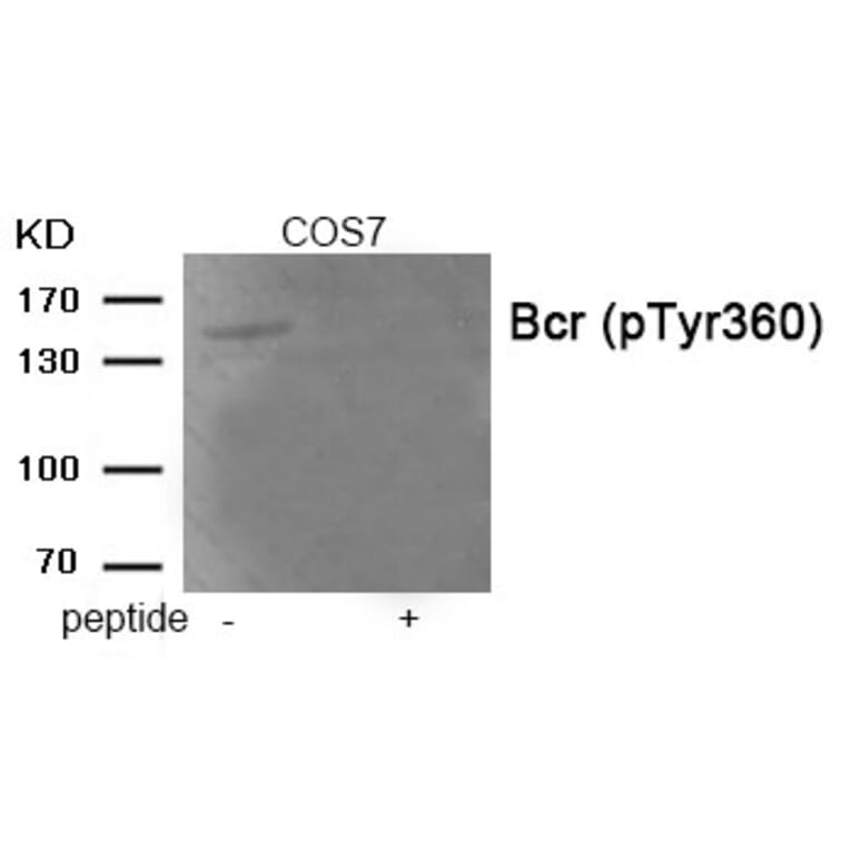 Western blot - Bcr (Phospho-Tyr360) Antibody from Signalway Antibody (11972) - Antibodies.com