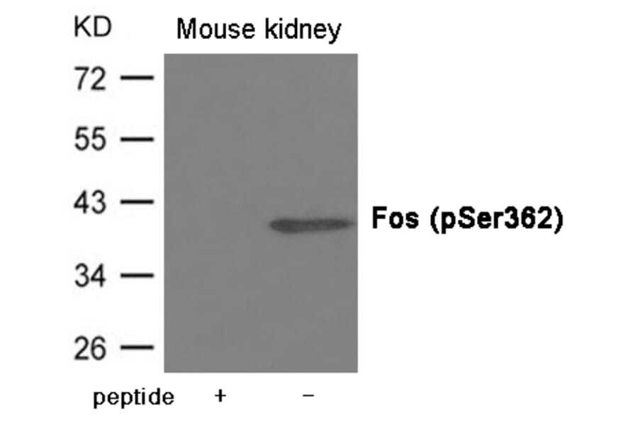 Western blot - Fos (Phospho-Ser362) Antibody from Signalway Antibody (12007) - Antibodies.com