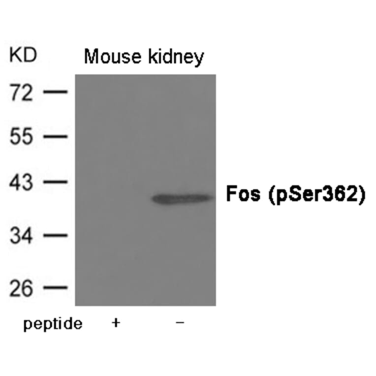 Western blot - Fos (Phospho-Ser362) Antibody from Signalway Antibody (12007) - Antibodies.com