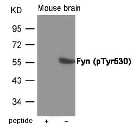Western blot - Fyn (Phospho-Tyr530) Antibody from Signalway Antibody (12008) - Antibodies.com