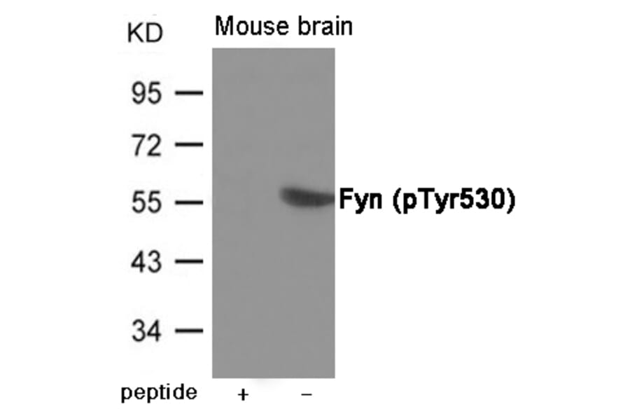 Western blot - Fyn (Phospho-Tyr530) Antibody from Signalway Antibody (12008) - Antibodies.com